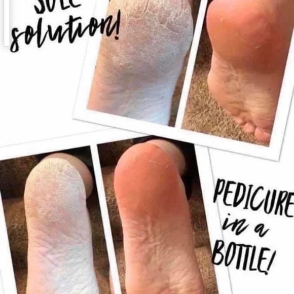 - (2) TWO Epoch NuSkin Sole Solution foot treatment